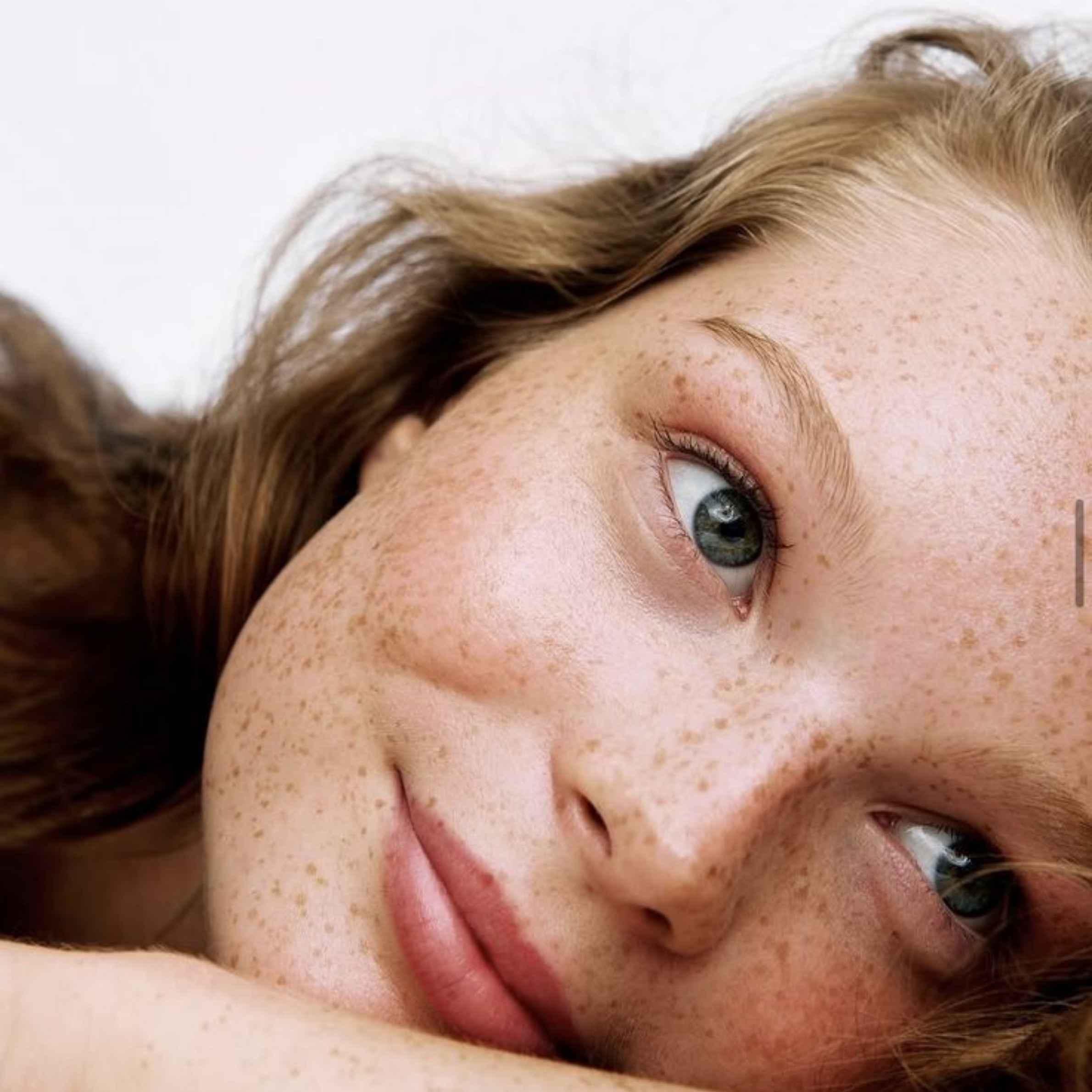 teenage skin